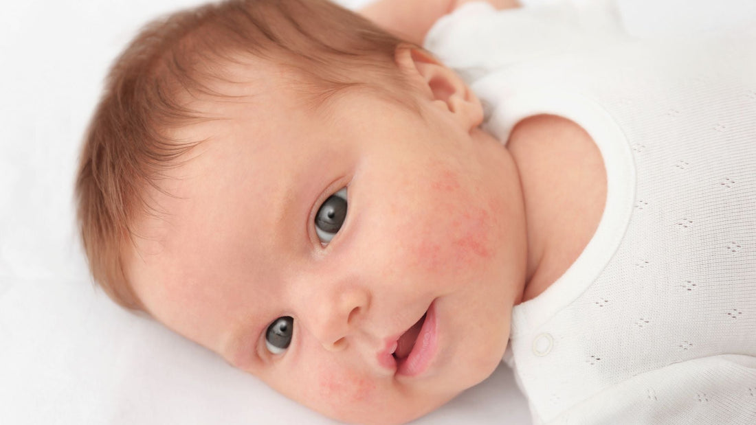 Choosing the Right Barrier Cream for Your Child and Why Ceramides Matter