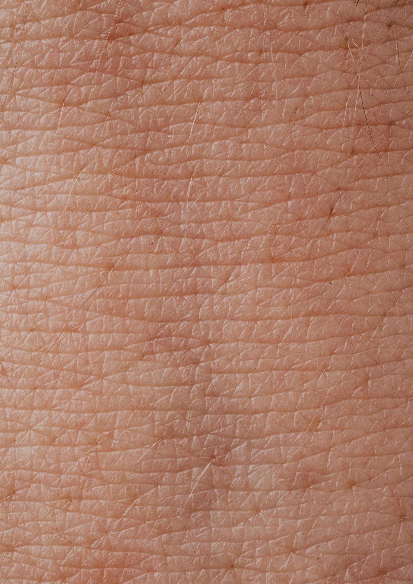 What Is the Skin Microbiome and Why It Matters for Sensitive Skin at Every Age