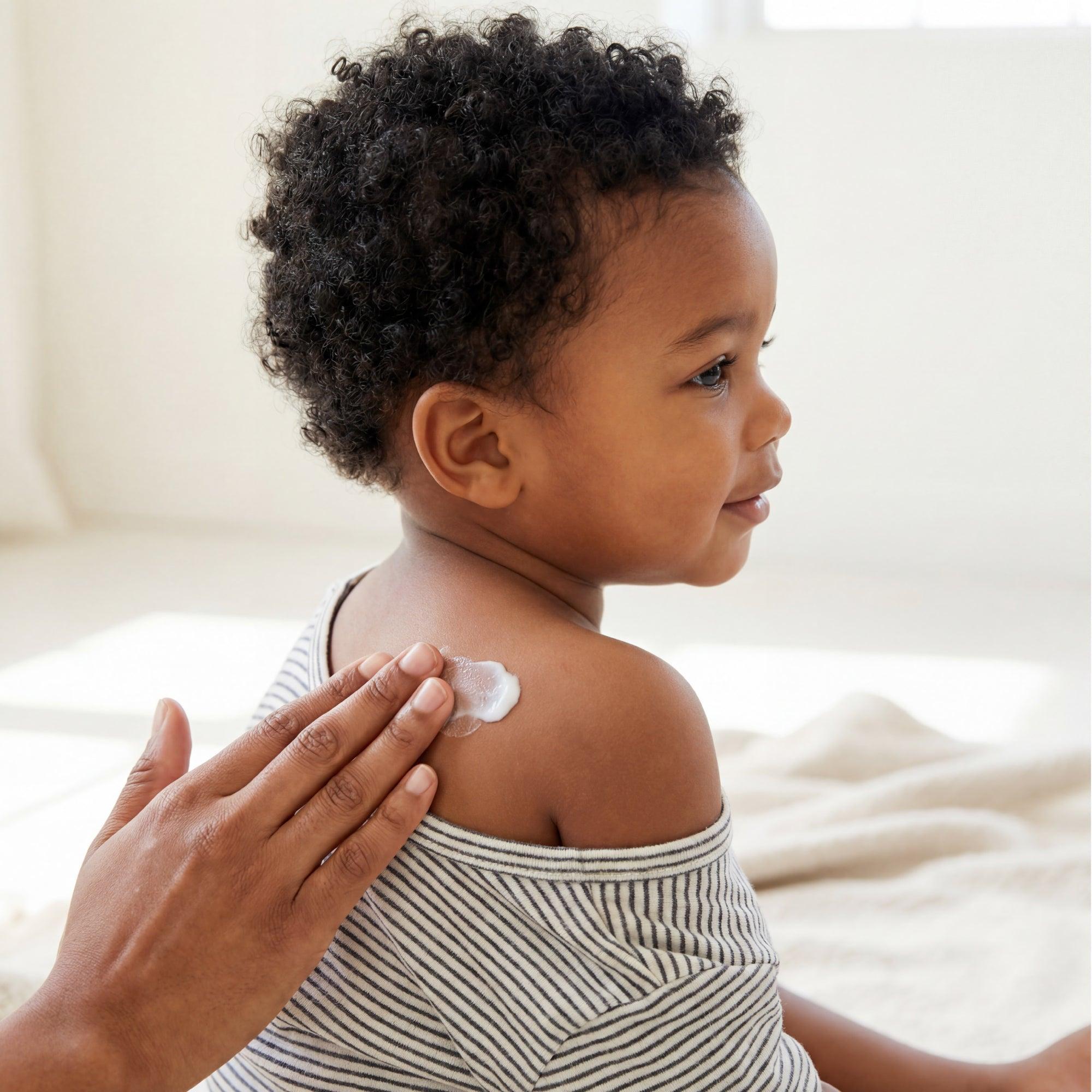 5 Everyday Things That Can Affect Your Child's Sensitive Skin