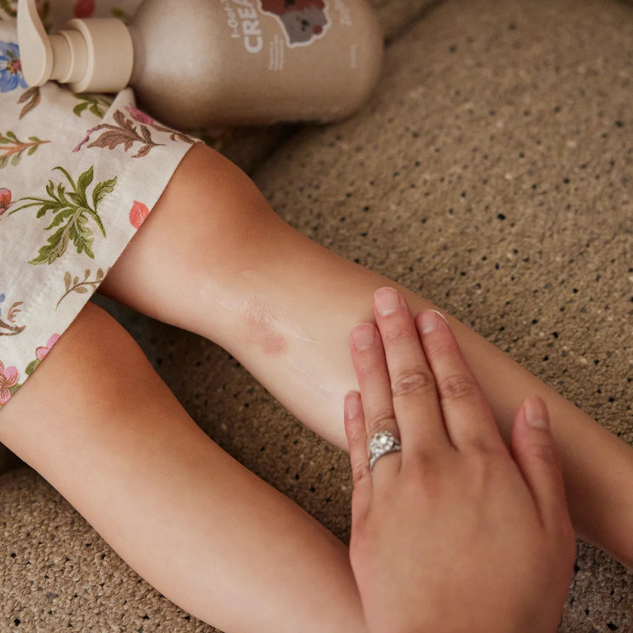 Massaging I-Got-You Cream into a child’s knee, bottle resting beside